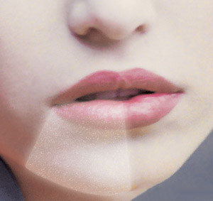 A representation of numbness caused by damage to a sensory nerve